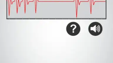 Screenshot von Monitor Heart Rate 5