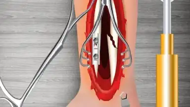 Screenshot von WristSurgeryDoctor 15