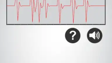 Screenshot von Heart Rate Monitor 4