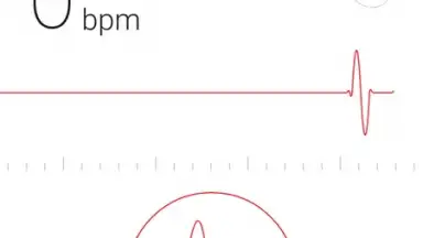 Screenshot von Cardiograph 5