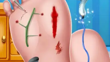 Screenshot von Foot Surgery Doctor Care 10