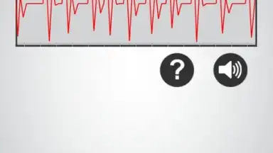 Screenshot von Monitor Heart Rate 4
