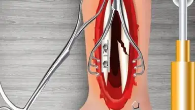 Screenshot von WristSurgeryDoctor 9