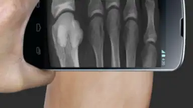 Screenshot von X Ray Scanner Pro 1