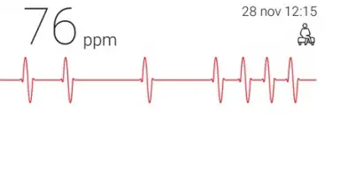 Screenshot von Cardiograph 2