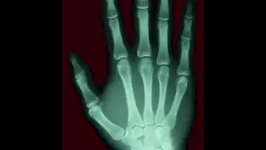 Screenshot von Scanner X-ray 5