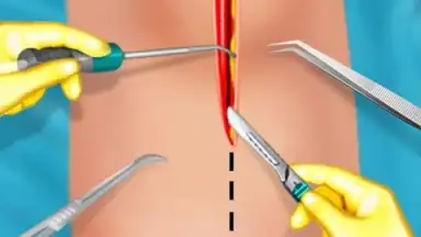 Screenshot von KneeSurgery 2