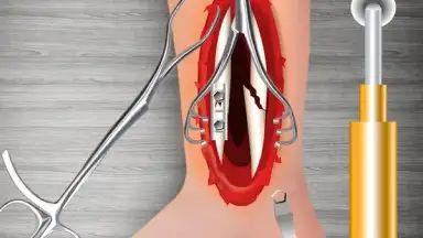 Screenshot von WristSurgeryDoctor 2