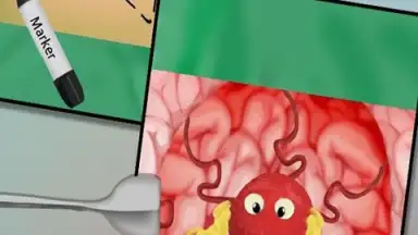 Screenshot von BrainSurgery 2
