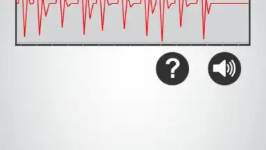Screenshot von Monitor Heart Rate 3