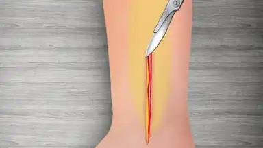 Screenshot von WristSurgeryDoctor 16