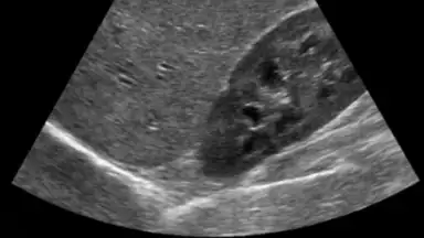 Screenshot von Scanner X-ray 3