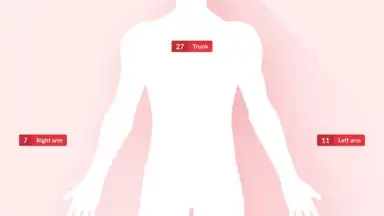 Screenshot von FotoSkin 6