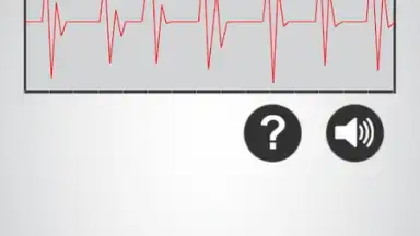 Screenshot von Heart Rate Monitor 2