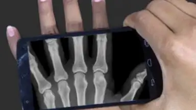 Screenshot von X Ray Scanner Pro 2